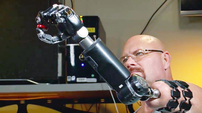 This Man Controls His Prosthetic Arm With His Thoughts