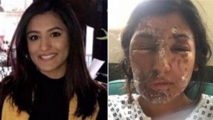 UK acid attack survivors demand government action